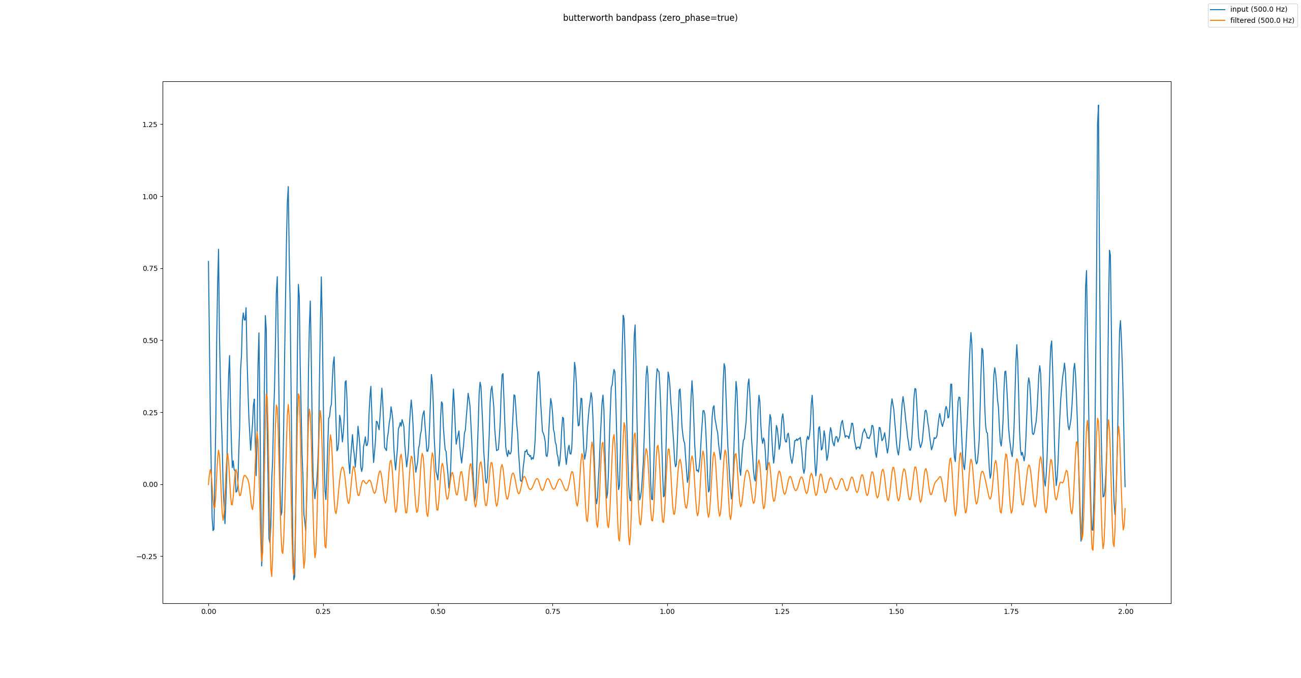 Butterworth Bandpassfilter ohne Offset-, mit Nullphasenkorrektur